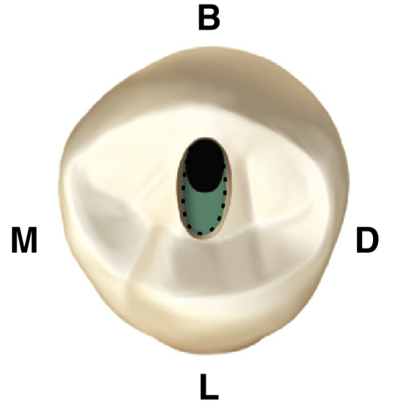 Gigi premolar ummacademy, outline form